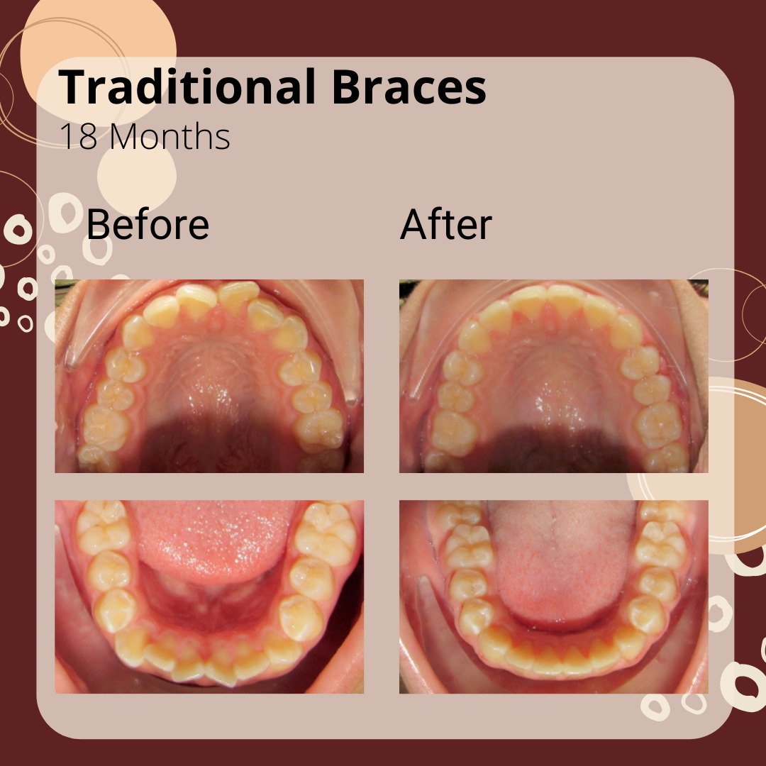 Before and After Knox Family Smiles