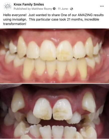 Knox Family Smiles Before and After